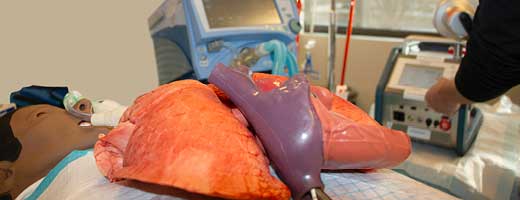 CHEST's Management of Advanced Heart and Lung Failure With ECMO and MCS course