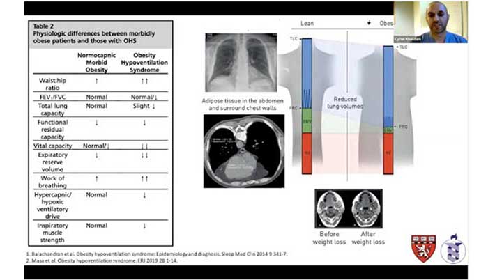 Pulmonary Hypertension in the Obesity Hypoventilation Syndrome: A Case Based Review