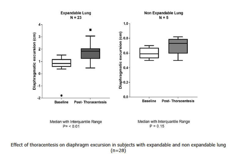 Thoracentesis on Diaphragm