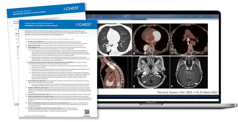 Lung scans and previews of the biomarker checklists