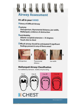 Airway Management Pocket Guide