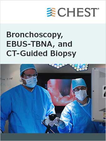 Bronchoscopy, EBUS-TBNA, and CT-Guided Biopsy