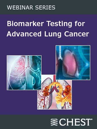 Lung Cancer Educational 3-Part Webinar Series