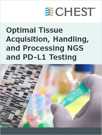 Optimal Tissue Acquisition, Handling, and Processing NGS and PD-L1 Testing