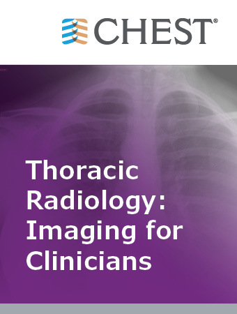 Thoracic Radiology: Imaging for Clinicians