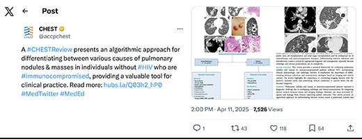 An X post on research