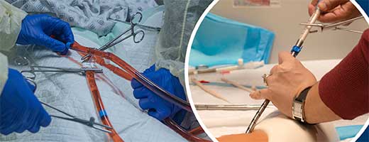 CHEST's Advanced ECMO Cannulation for VV, VA, and ECPR course