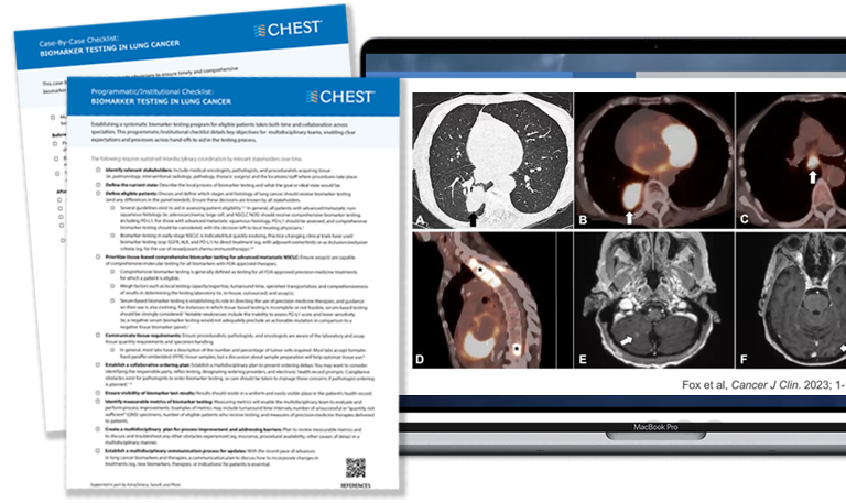 Lung scans and previews of the biomarker checklists 