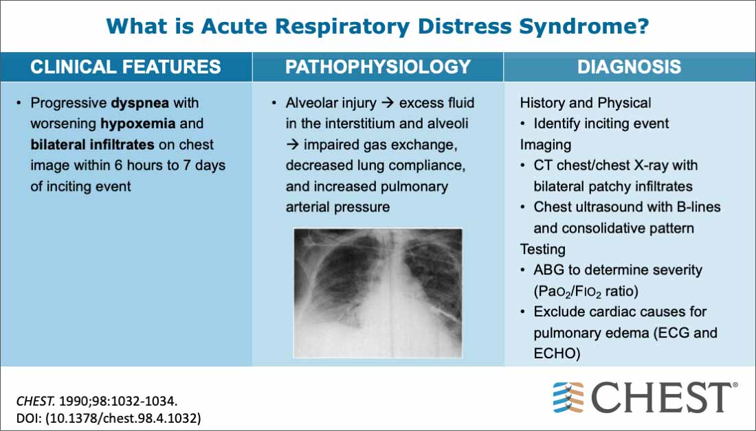 What is ARDS?