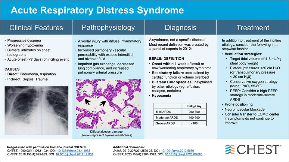 Acute Respiratory Distress Syndrome infographic