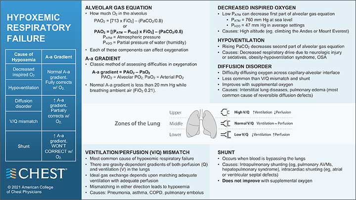 Hypoxemic Respiratory Failure infographic