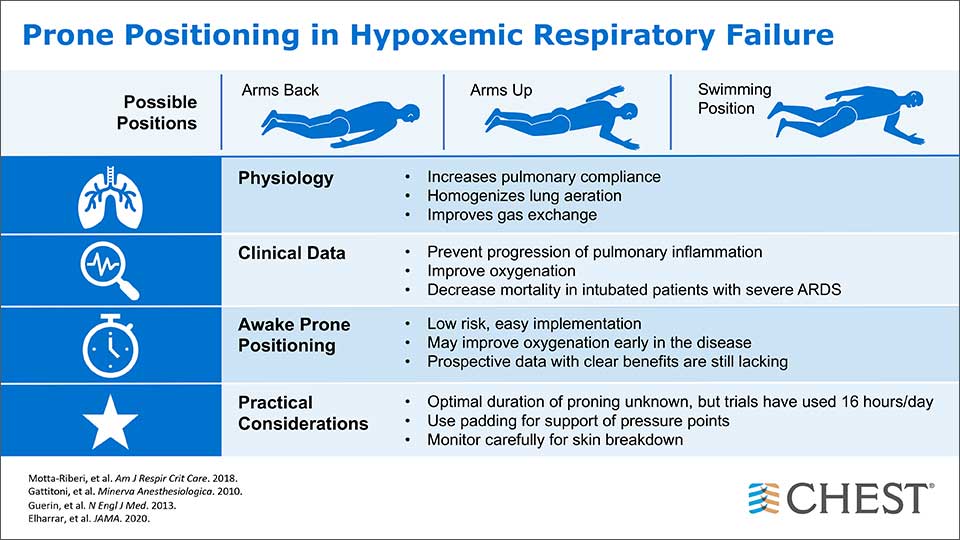Prone positioning in hypoxemic respiratory failure infographic