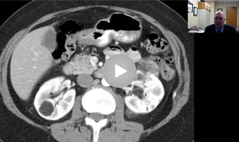 Imaging of Cystic Lung Disease