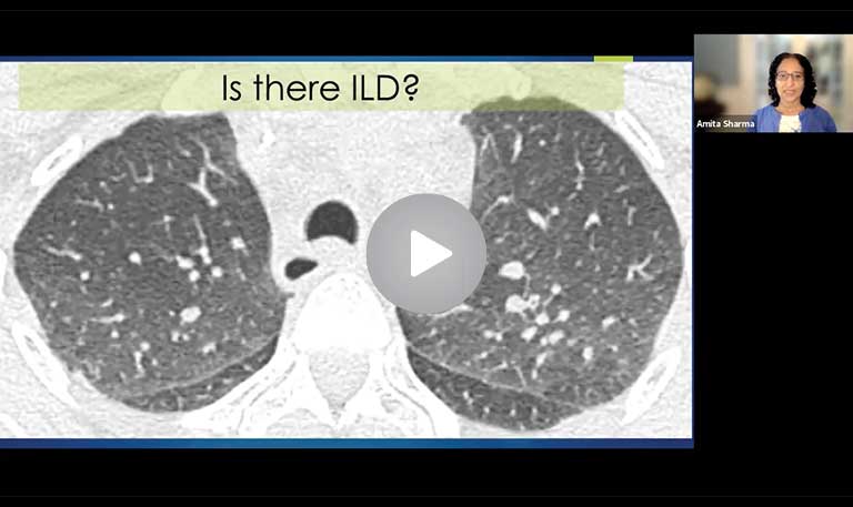 Approach to HRCT Scans