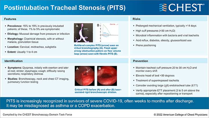 Post-Intubation Tracheal Stenosis (PITS)