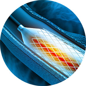 Bacteria mycobacterium abscessus