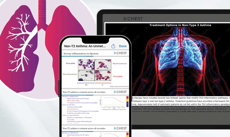 CHEST Curriculum Pathway products on digital devices