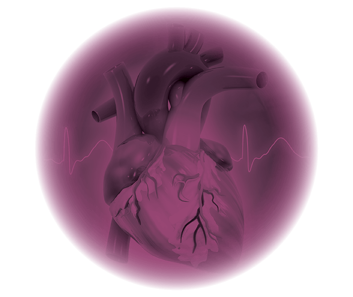 An artistic rendering of heart catheterization